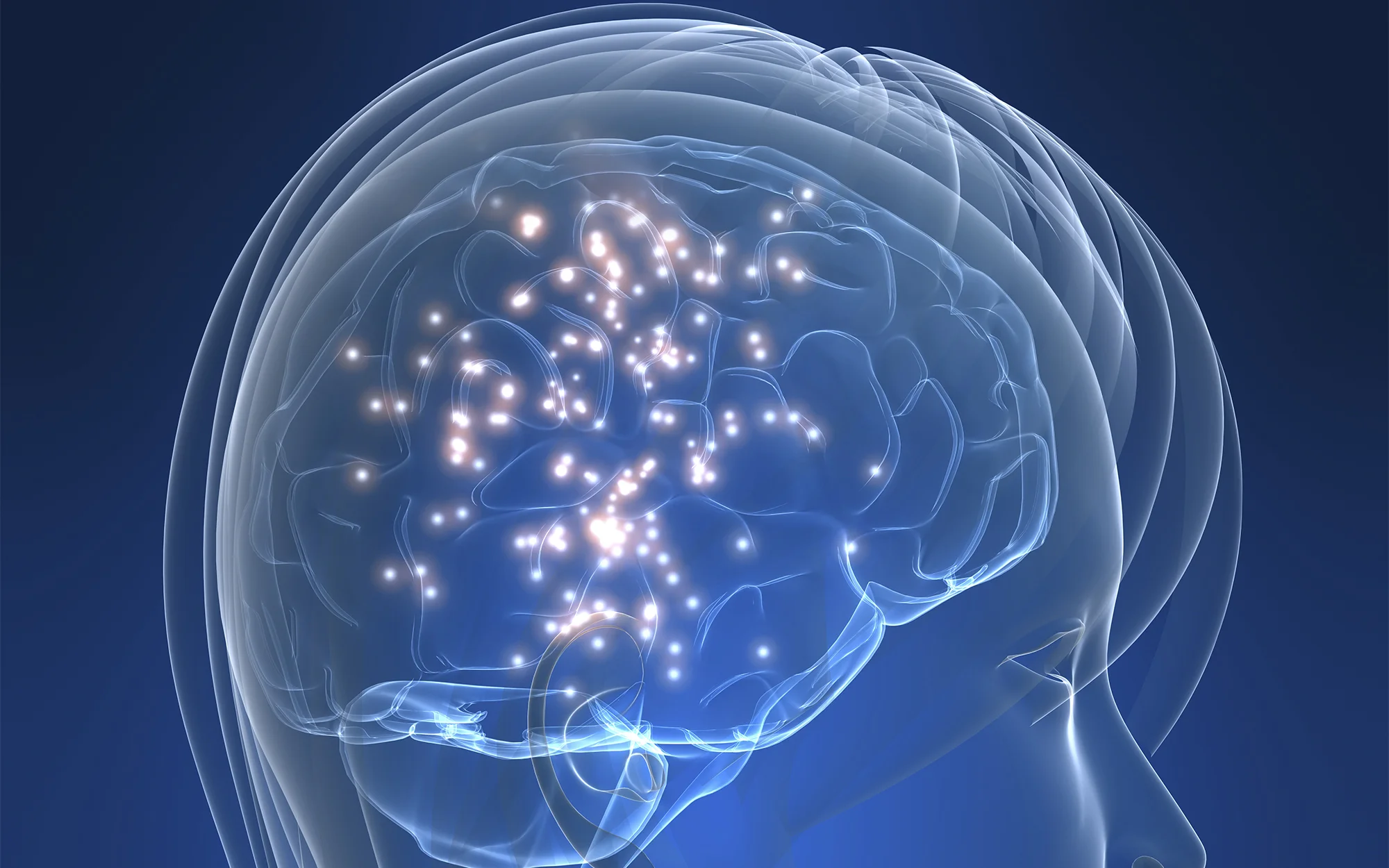 Traitement de la Migraine à Lausanne
